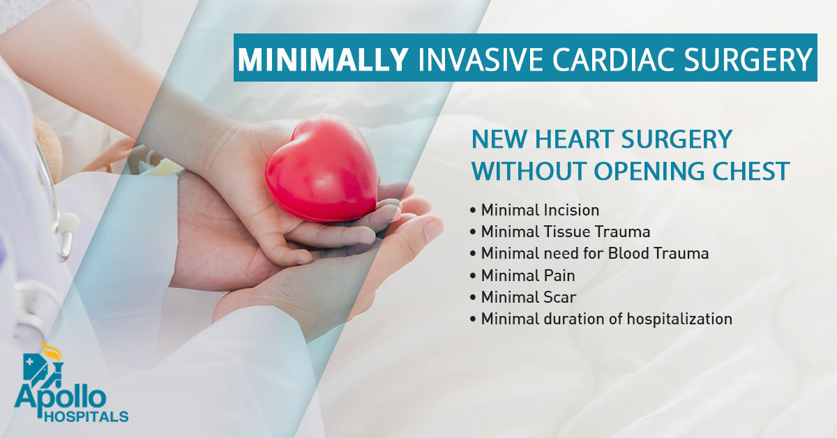 Minimally Invasive Cardiac Surgery-MICS