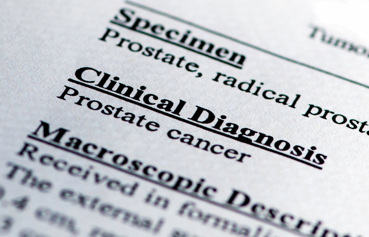 What’s the Difference Between a Regular Prostate Biopsy and Mri Fusion Biopsy