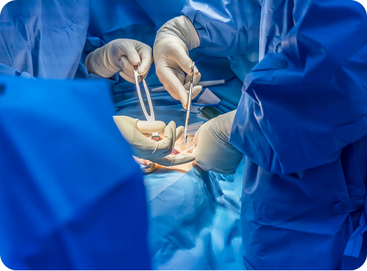 Procedure