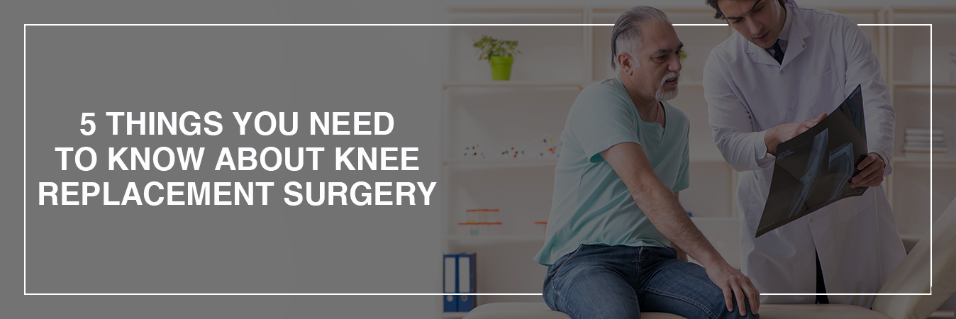 5 Things You Need To Know About Knee Replacement Surgery