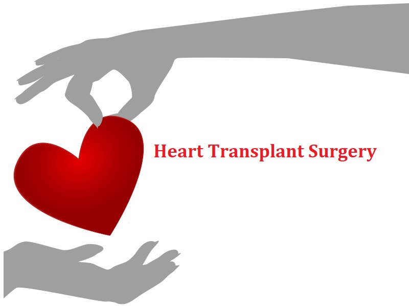 Frequently Asked Questions about Heart Transplant Surgery