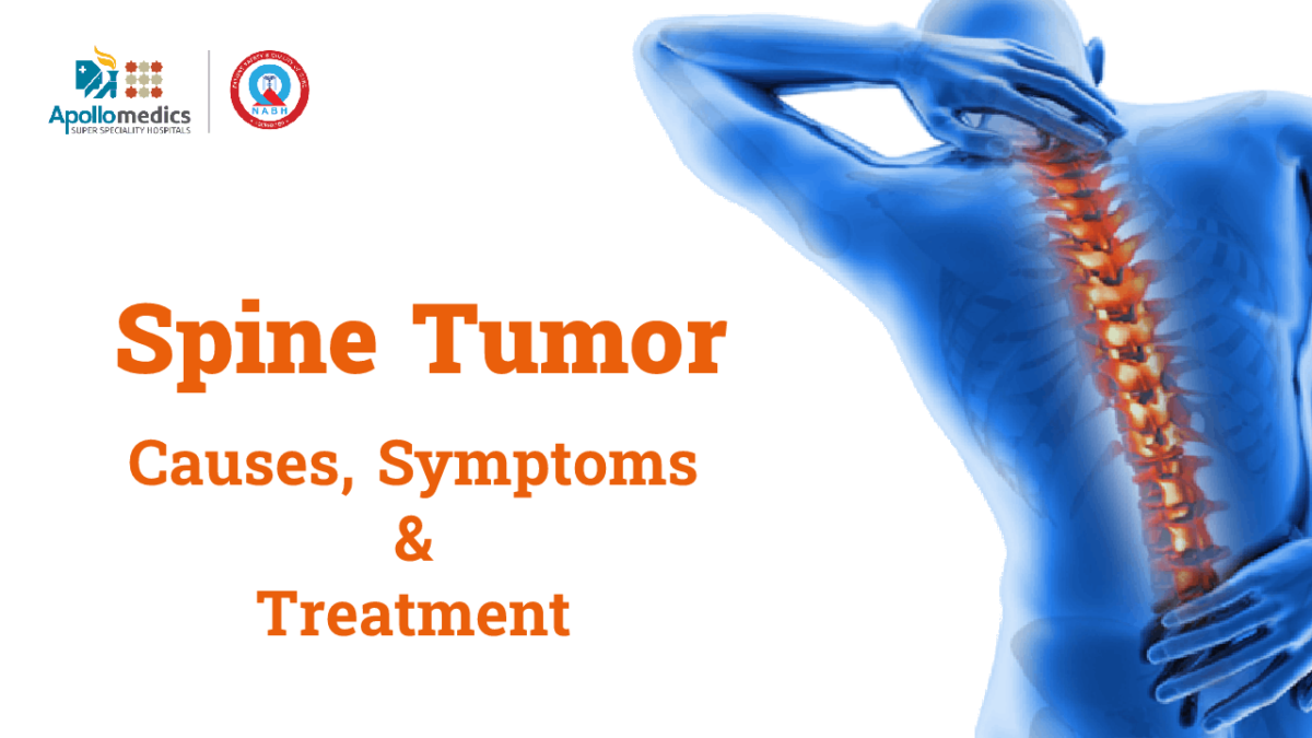 Spine Tumor Causes, Symptoms & Treatment Options