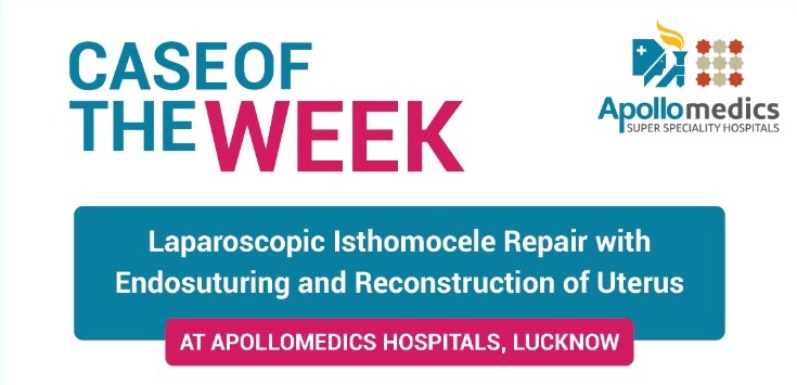 Laparoscopic Isthomocele Repair