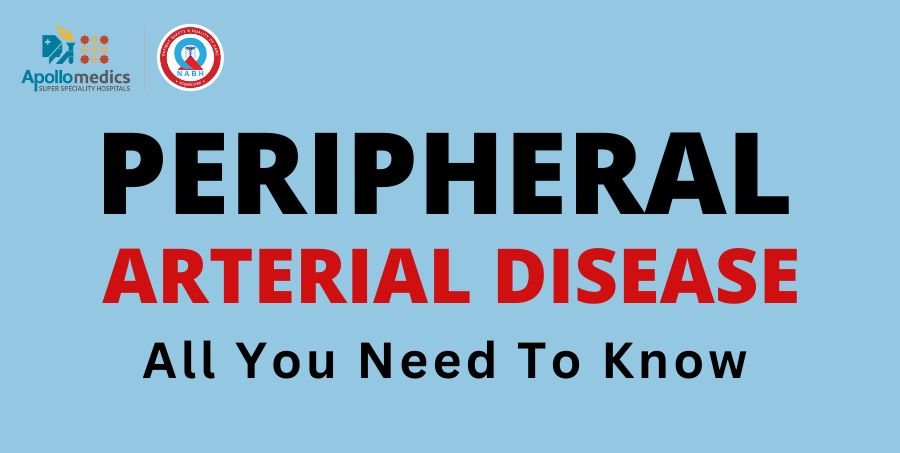 All You Need to Know about Peripheral Artery Disease