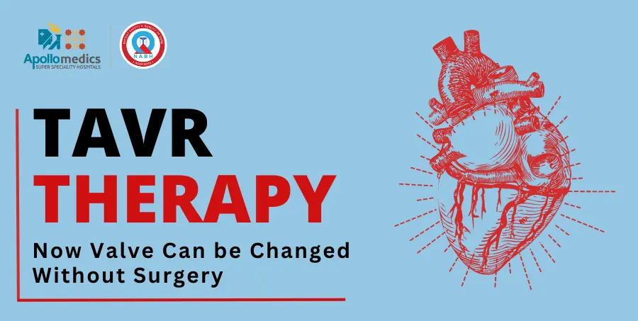 TAVR Therapy- Now Valve Can be Changed Without Surgery