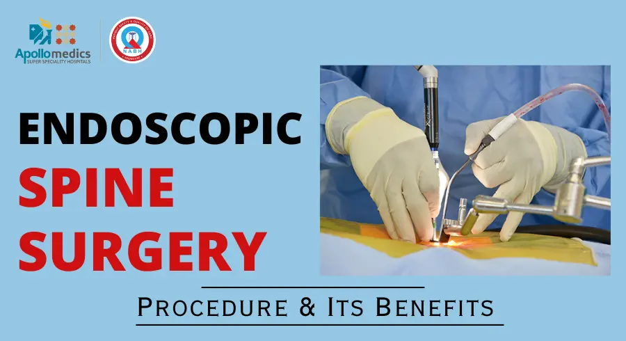 Endoscopic Spine Surgery Lucknow