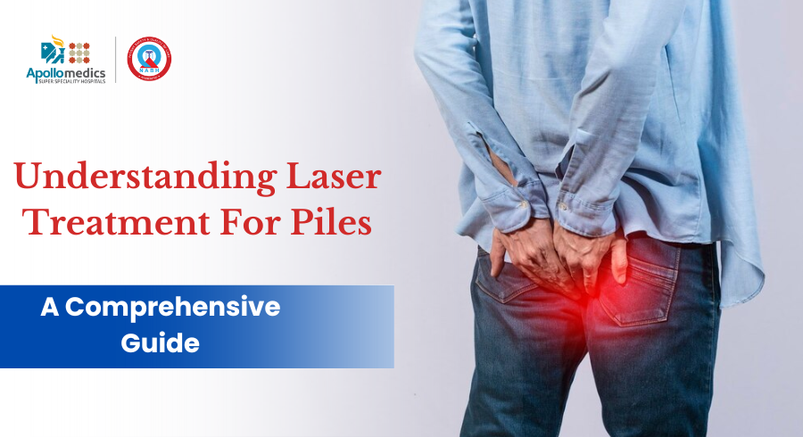 Understanding Laser Treatment for Piles