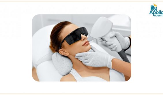 Laser Hair Removal – yay or nay?