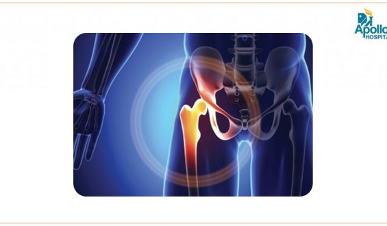 Hip Surgery: Everything you should know