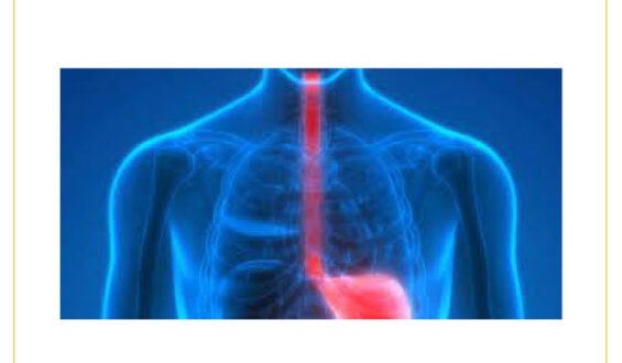 Esophageal Cancer: Important Facts