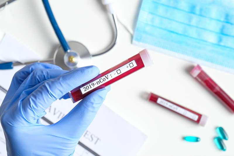 Interim Health advisory on the 2019 Novel Coronavirus (2019-nCoV)