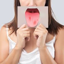 Busting Myths & Facts about Oral Cancer