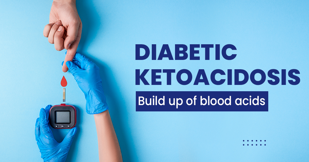 Diabetic Ketoacidosis (DKA)