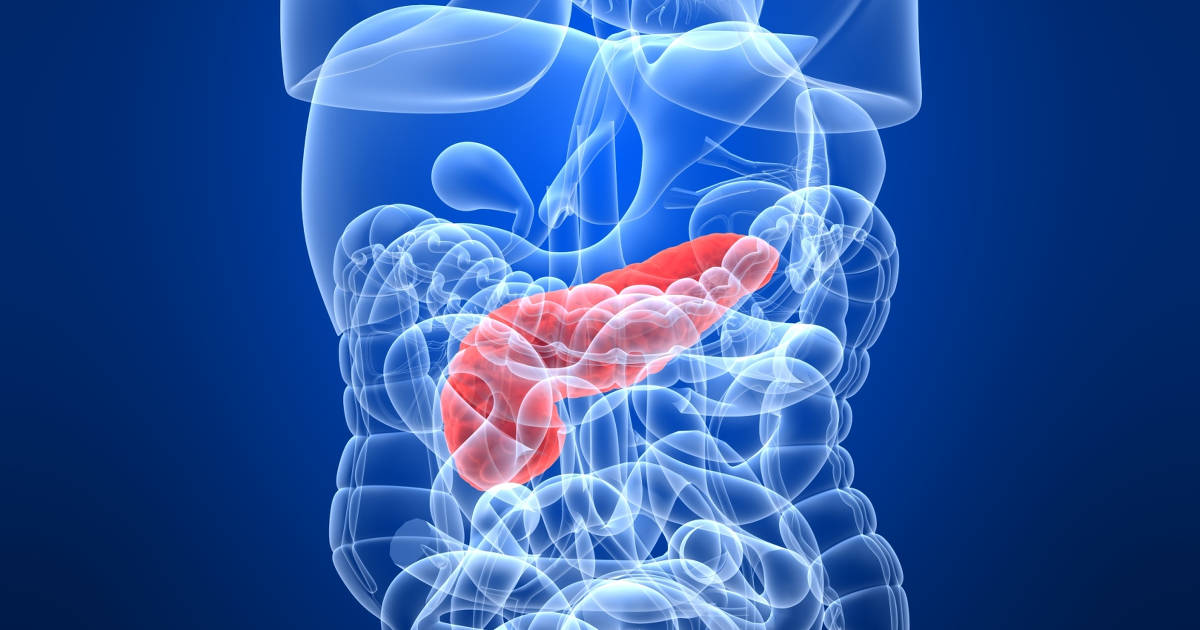 Understanding-the-Stages-of-Pancreatic-Cancer-and-Why-They-Matter Understanding-the-Stages-of-Pancreatic-Cancer-and-Why-They-Matter